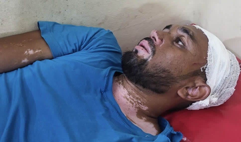 ধুনটে কর্মকর্তার সামনে ডিলারশিপপ্রার্থীর ওপর হামলা, তদন্ত স্থগিত